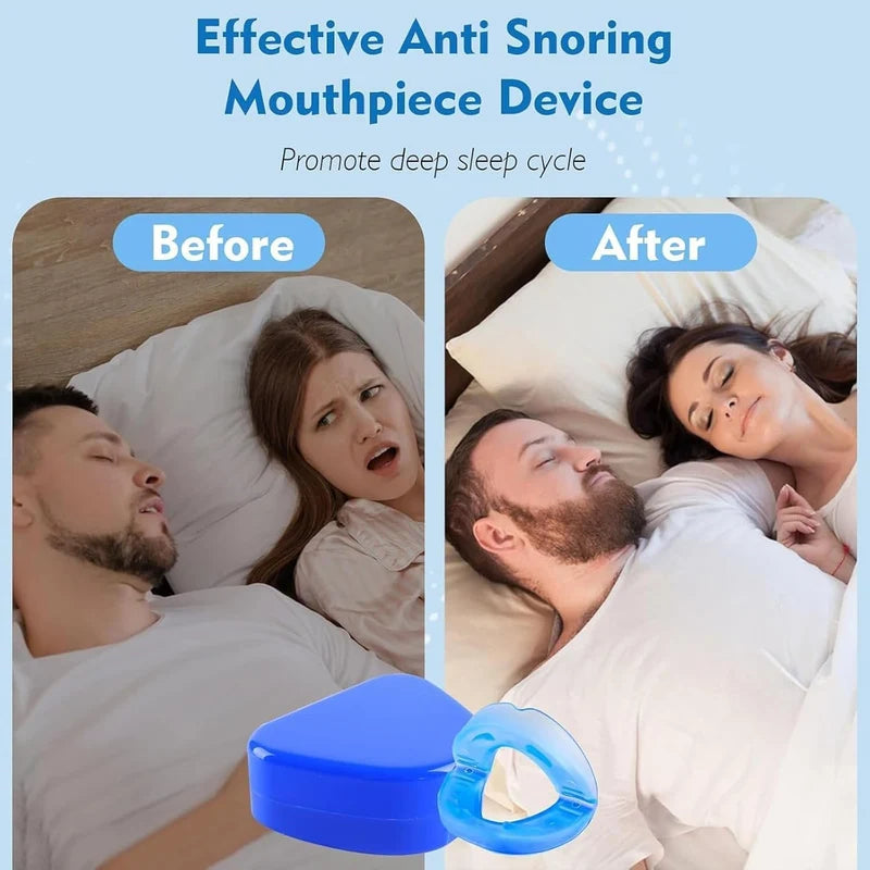 Anti-Snore Mouthpiece – Comfortable Night-Time Snoring Support